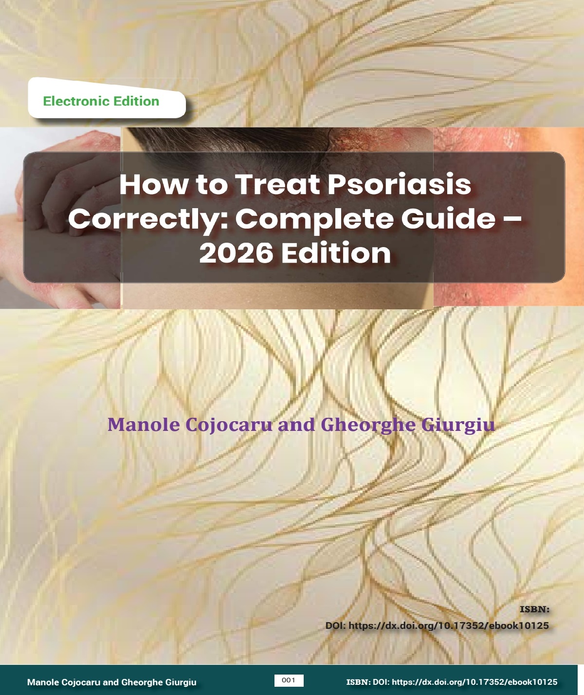 Ebook How to Treat Psoriasis Yourself Correctly: Complete Guide – 2026 Edition